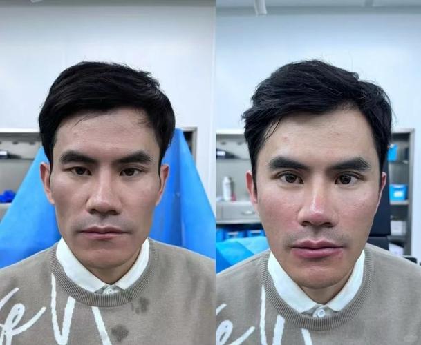 男生整形后富贵面相会改变吗？