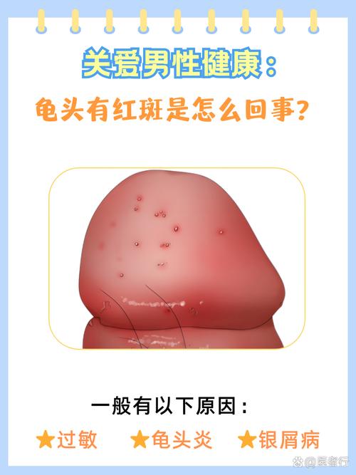 龟毛男人的特征究竟是什么他们的性格特点有哪些？