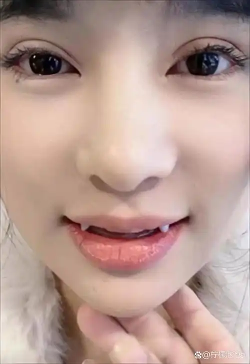 女生长虎牙的面相有什么特殊含义？