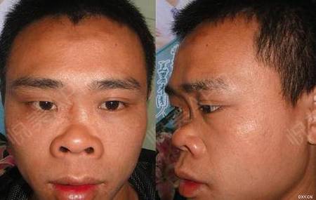 塌鼻梁的人命运究竟如何，会影响人生走向吗？