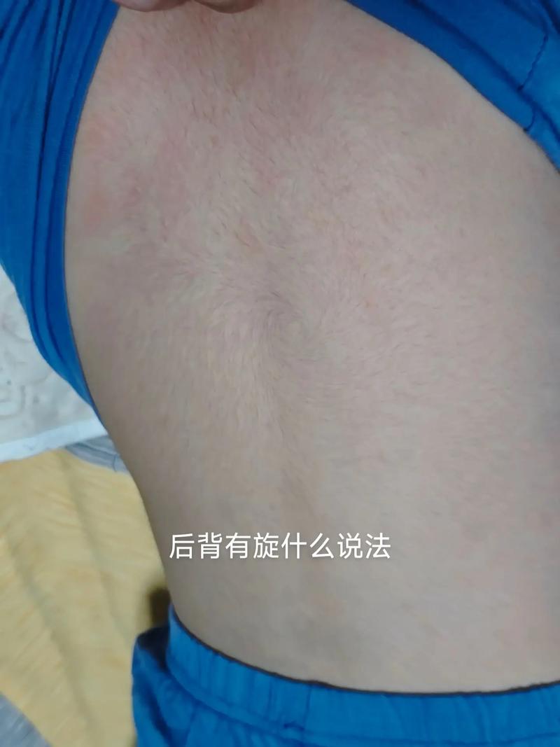 女孩子为什么背上会长出像漩涡一样的纹路？