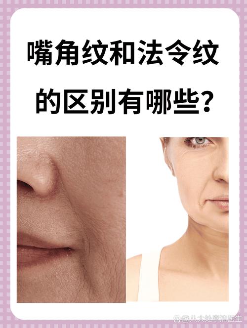 嘴角两侧法令纹入法令纹代表什么是恶相吗？