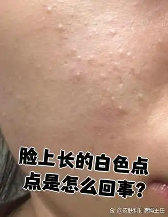 梦见脸上出现白点点是什么预兆？