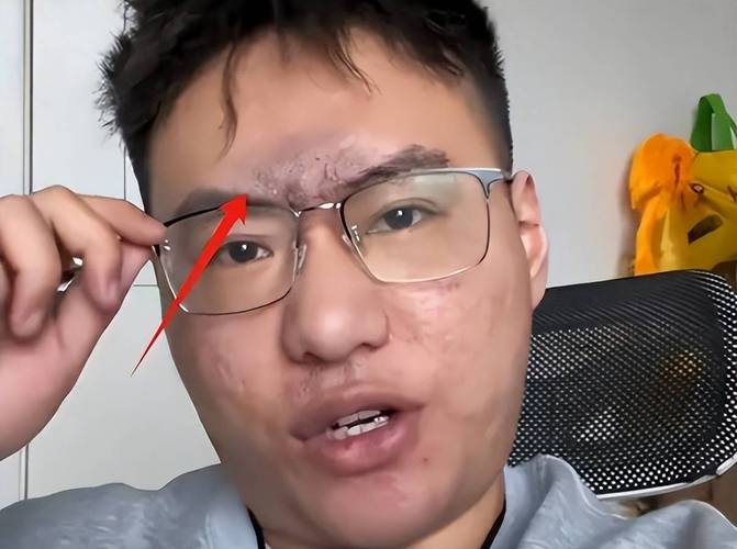人老面相变丑的原因是什么？吸毒面相为什么会变得难堪？