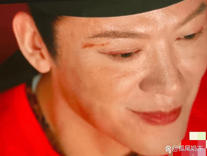 右眼皮疤痕面相是什么意思？