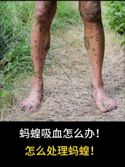 梦见被蚂蝗咬脚吸血是什么预兆？预示着什么不好的事情即将发生？