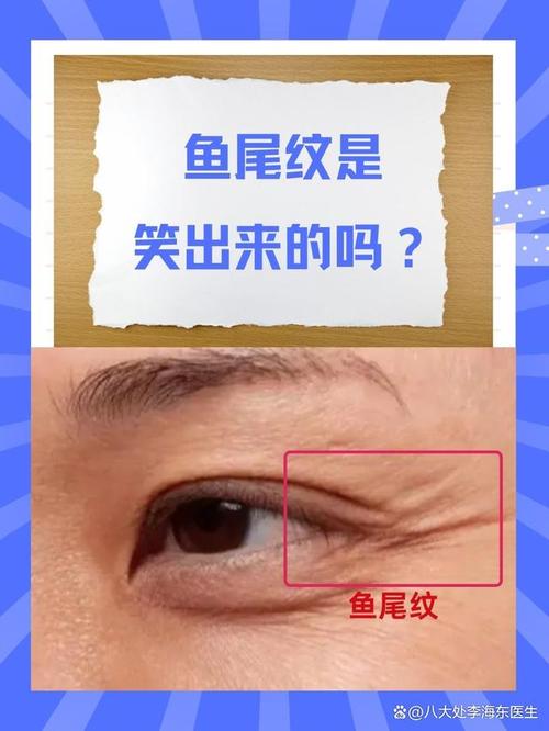 男性笑出鱼尾纹的面相，命运会如何变化？