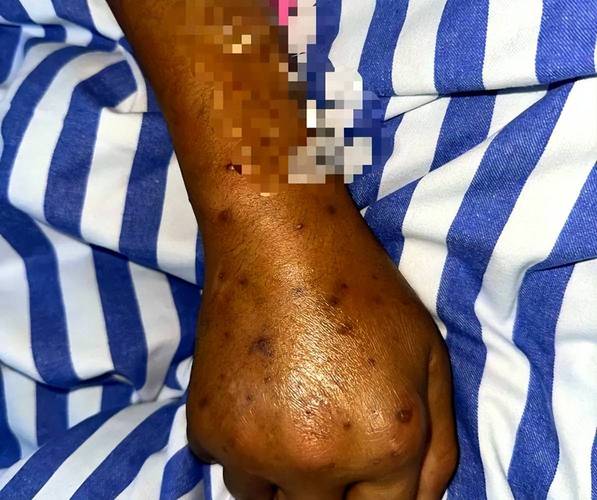 梦见黄蜂和死人的预兆是什么？蜂群蛰死人的梦境意味着什么？