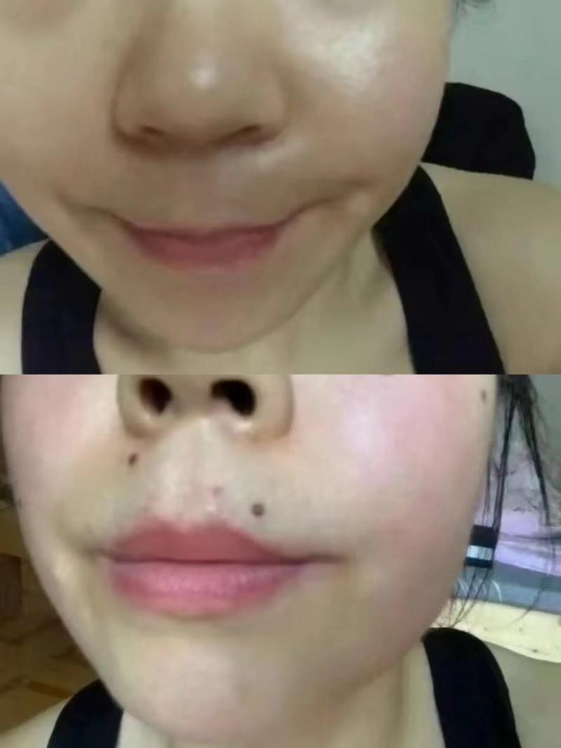 鼻子上长痣的人财运会好吗？
