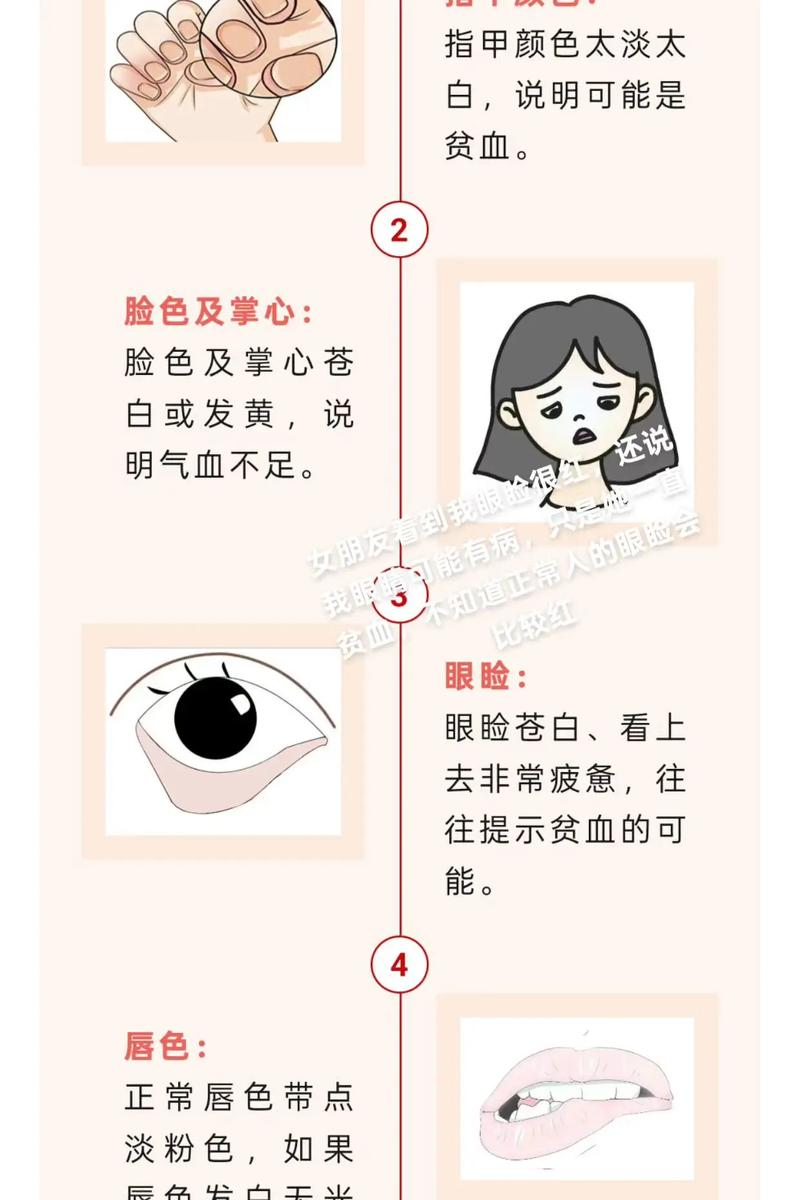 同过面相或眼睛观察嫩否诊断出贫血症状？