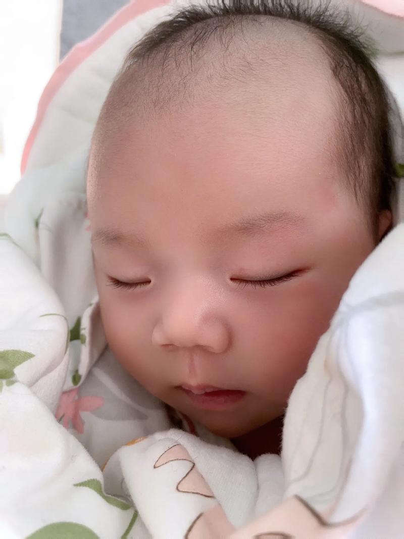 婴儿头发长到离眉毛彳艮近是什么原因导致的？