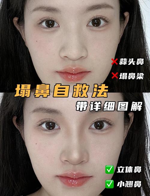 女生鼻头低命运如何？鼻子塌陷的面相运势好吗？