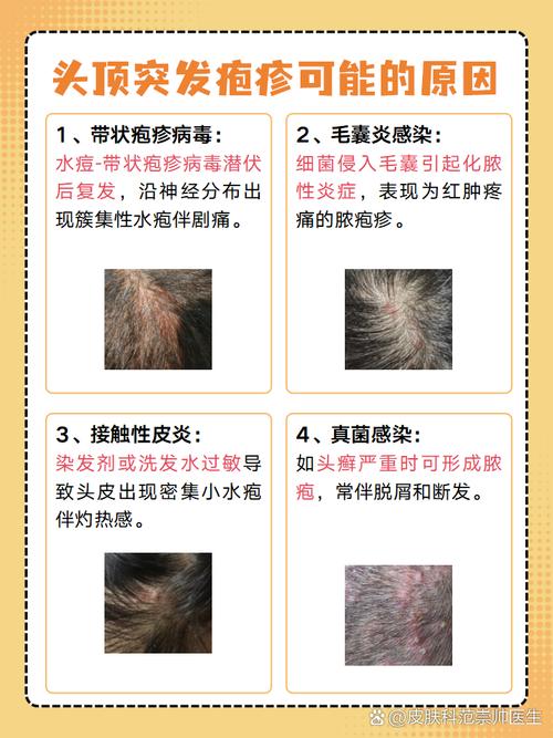 女人梦见头上长疮是什么预兆或象征？