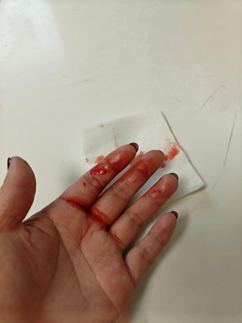 梦见手指被扎是什么预兆？预示着什么不好的事情发生？