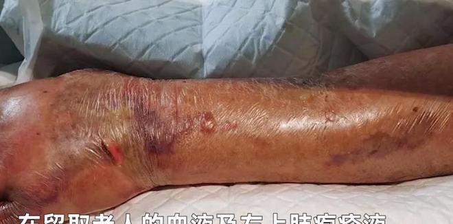 孕妇梦见洗虾是什么预兆？梦见洗鱼虾有什么特殊含义？