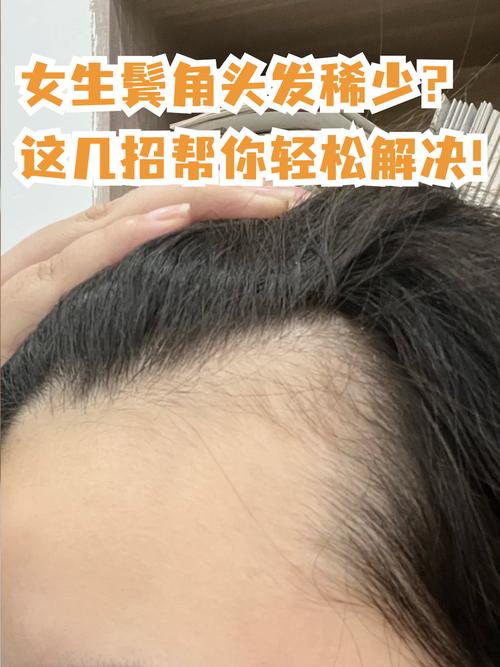 刮鬓角后女生运气会变差吗？剃鬓角对女生运势有影响吗？
