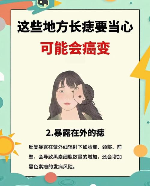 痣突然自己淡化消失，预示着什么征兆或变化？