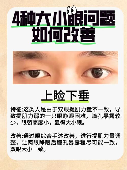 如何通过手术或非手术方法改善眼睛一大一小的面相问题？