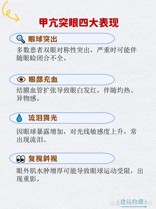 什么样的八字特征会导致看人眼光高，即眼睛看起来较大？