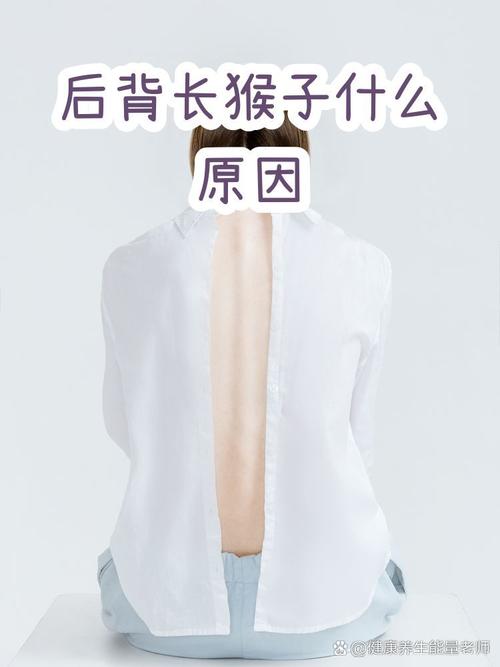 后背有猴子命运（背上有瘊子）的人命运究竟如何？