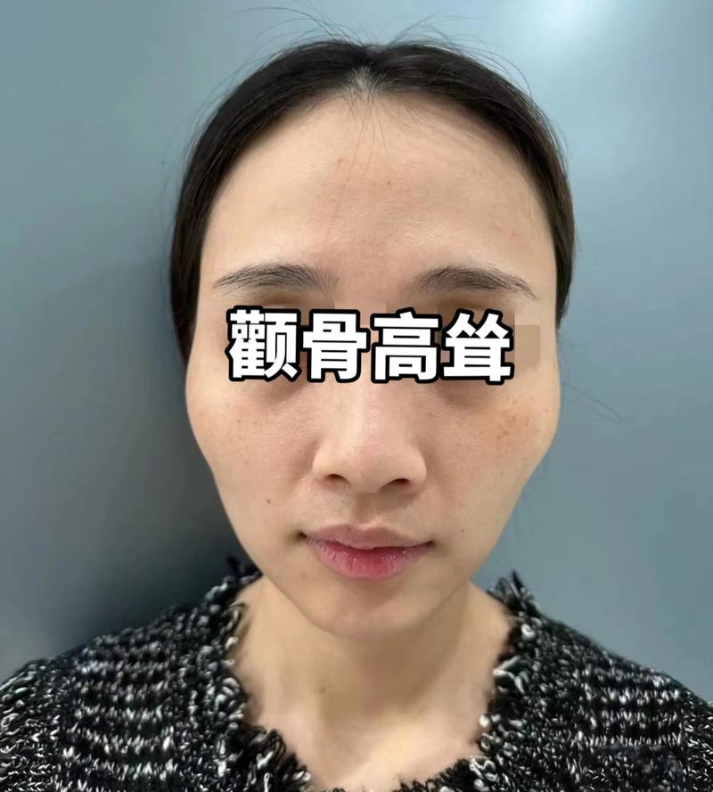 女人颧骨突出面相是否代表好运和福气？