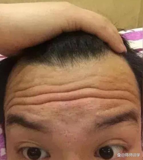 额头皱纹对男性命运有何影响？
