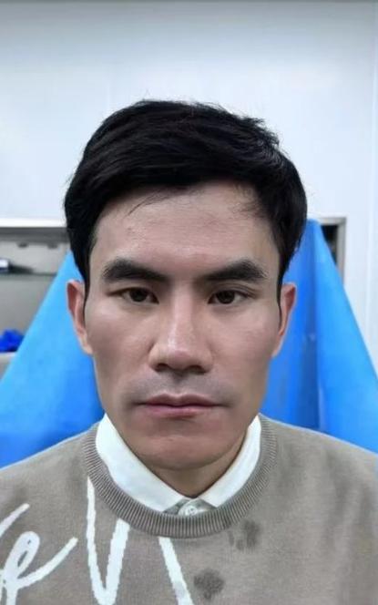 男生整形后富贵面相会改变吗？