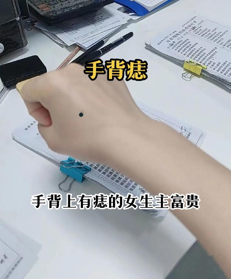 右手手背长痣的女人有什么特殊含义？