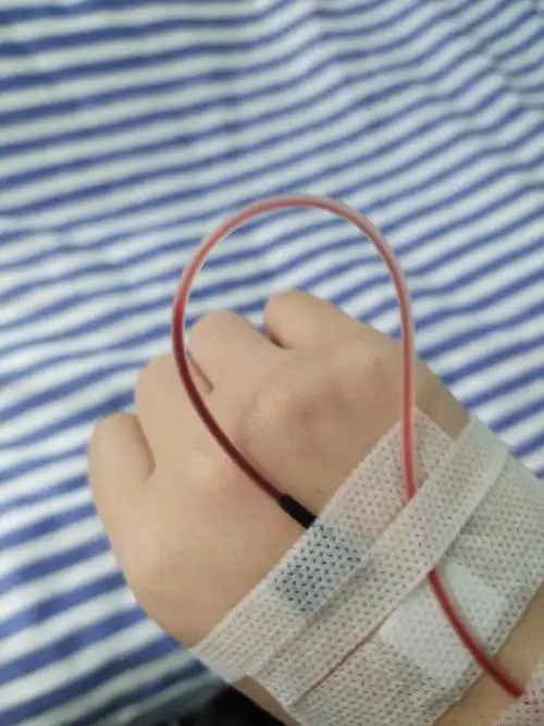 梦见打针回血是什么预兆？