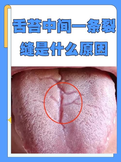 梦见舌头断裂且无出血现象，预示着什么征兆或含义？