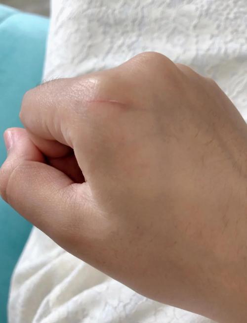 女人梦到被猫抓伤手是什么征兆？预示着什么不好的事情即将发生？
