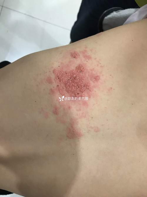 身上跟着龙仙，会有哪些奇特症状或征兆显现？