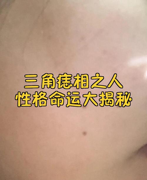 三颗痣形成三角形的人命运究竟如何？