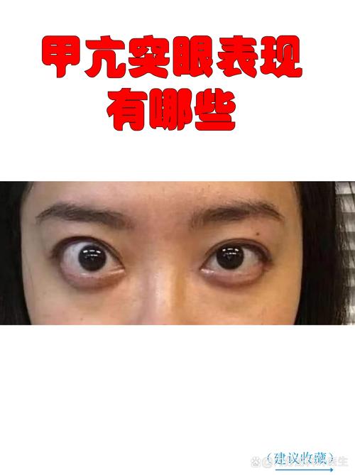 什么样的八字特征会导致看人眼光高，即眼睛看起来较大？