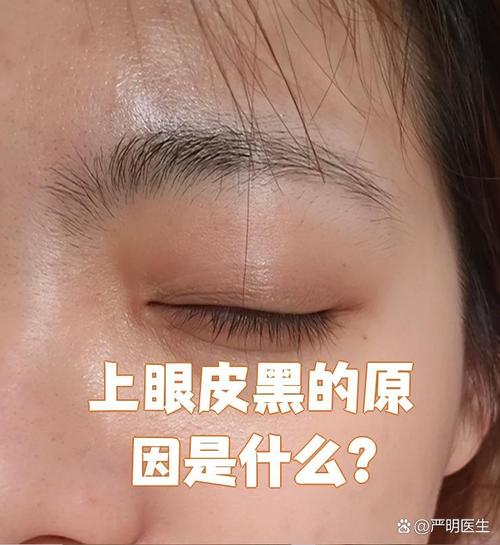 上眼皮黑面相是什么意思？