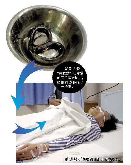女人梦见鱼或黄鳝钻进下身，这是什么预兆？