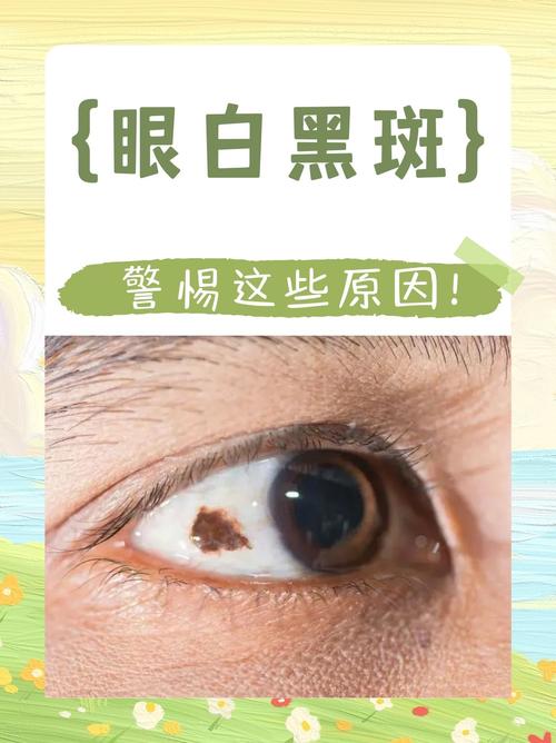 梦见眼白变黑是什么预兆？预示着什么不好的事情即将发生？