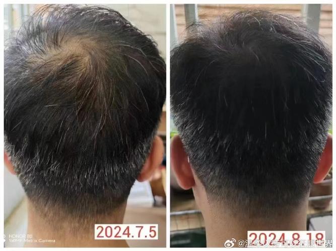 梦见头发一半黑一半白是什么预兆或象征？