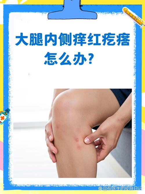 梦见大腿掉落红肿是什么预兆？预示着什么不好的事情？