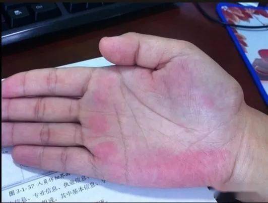 一、 手掌比熊掌还厚