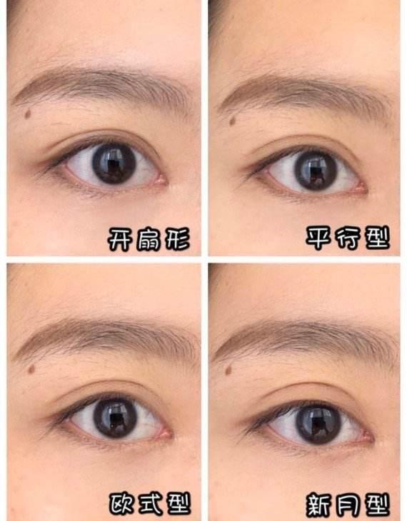 割双眼皮会影响面相吗？面相会因此改写吗？