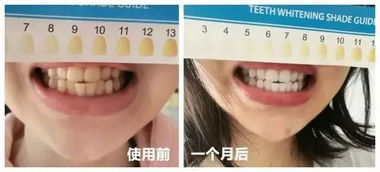 梦到掉牙运势测算准确率极高，这真的靠谱吗？