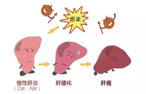 隳肝沥胆的生肖是哪个？
