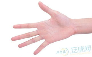 从手相看手心发红
