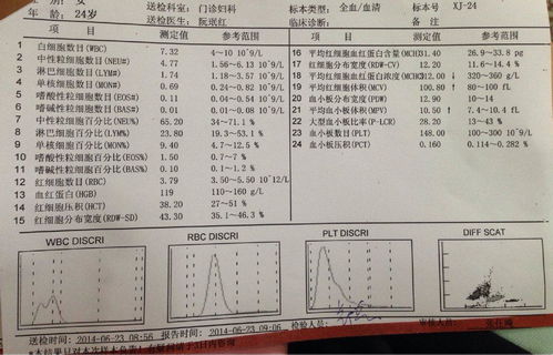 四、 定制化觉得能