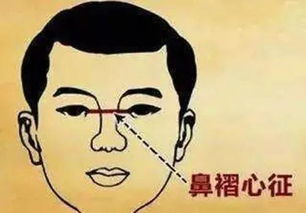 3. 疾病