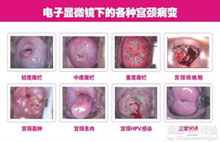 二、作用于恢复周期的最主要因素是哪些？