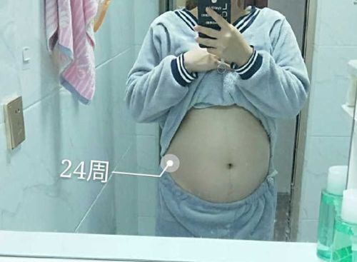 2. 饮食习惯暴击