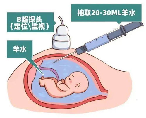 三、评估肿瘤风险因素：别把癌症当成副作用