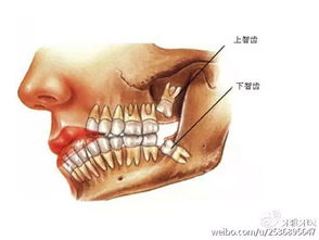 智齿的终极真相：看完哭晕